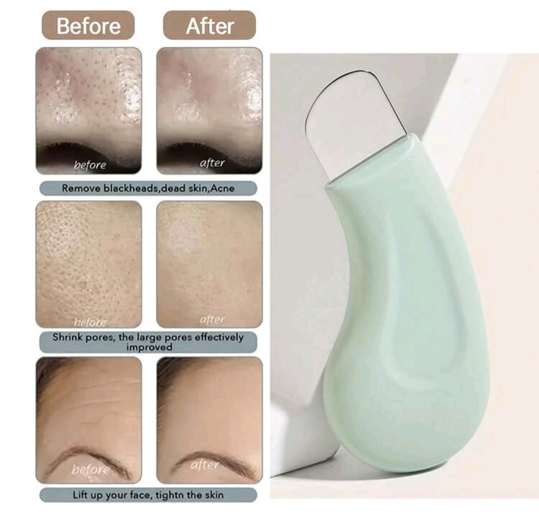 Blackhead Removal Tool