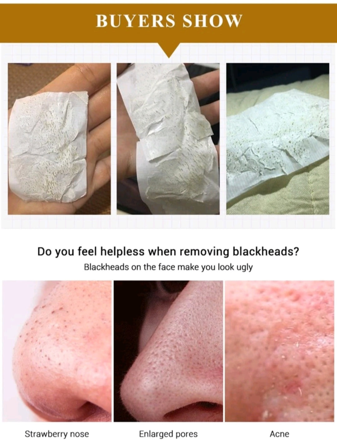 Blackhead Removal Facial Patch